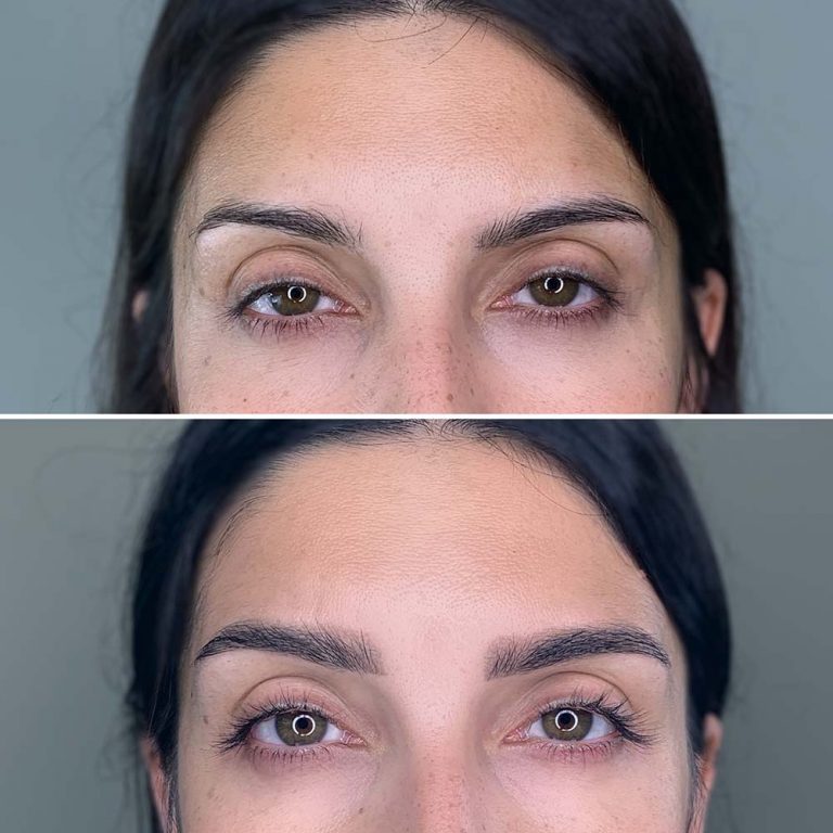 Tratamientos y precios - Beauty Boutique Rubí